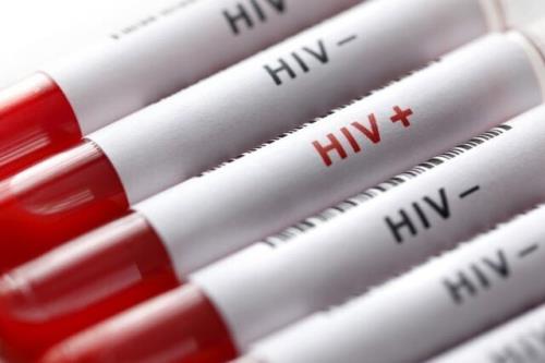 آخرین آمار ایدز در کشور