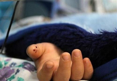 مرگ تلخ دختربچه 4 ساله در بیمارستان