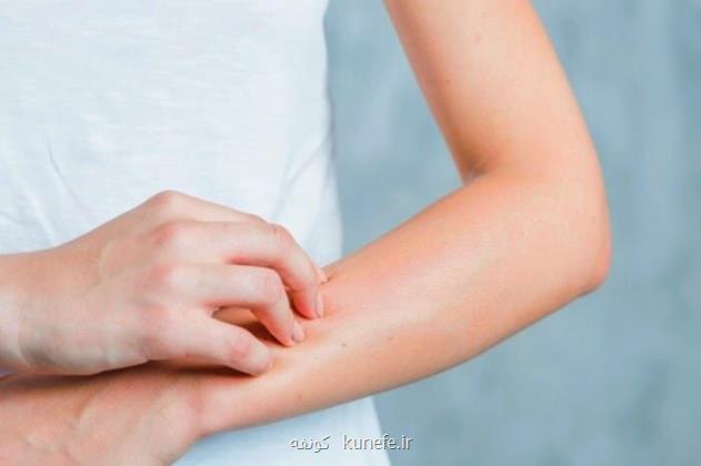 ۷ روش ساده برای پیشگیری از شل شدن پوست