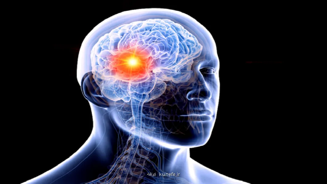 نگاهی جدید برای درمان یکی از خطرناک ترین تومور های مغزی