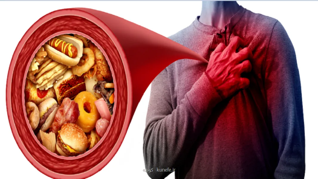 نتایج غیرمنتظره در مورد تأثیر چربی اشباع بر سلامت قلب