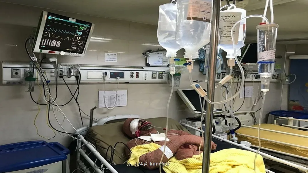 درمان سوختگی با شیوه های سنتی و دارو های محلی، علمی نیست به علاوه فیلم